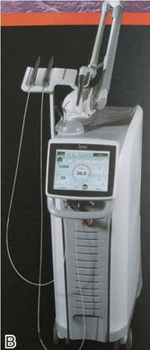 口腔医学中的激光医疗设备 原理、应用与前景